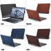 لابتوب Lenovo Yoga C940 Core i7 جيل 10 شاشة لمس 14 بوصة FHD وذاكرة 12GB وSSD 512GB لابتوب Lenovo Yoga C940 Core i7 جيل 10 شاشة لمس 14 بوصة FHD وذاكرة 12GB وSSD 512GB